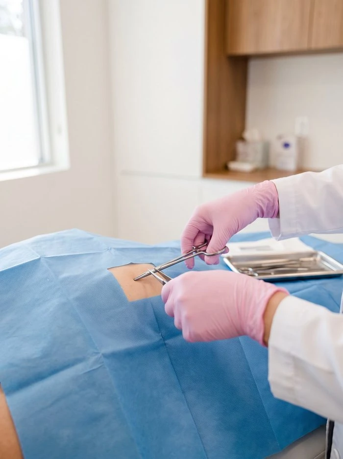 Exérese de Lesão na FC Dermatologia, em Blumenau
