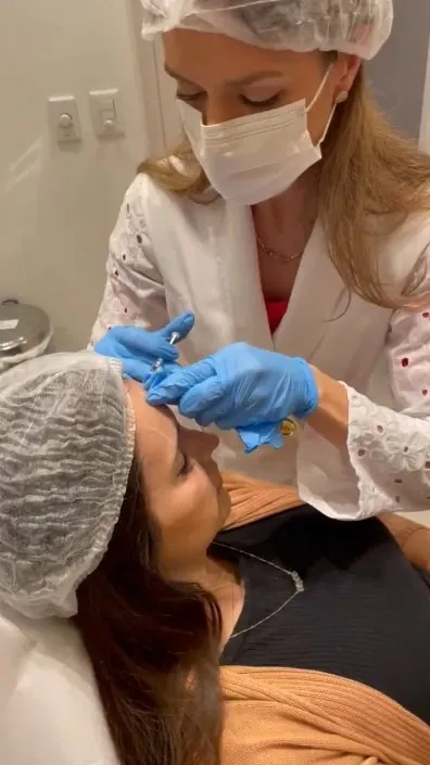 Preenchimento com ácido hialurônico na FC Dermatologia, em Blumenau